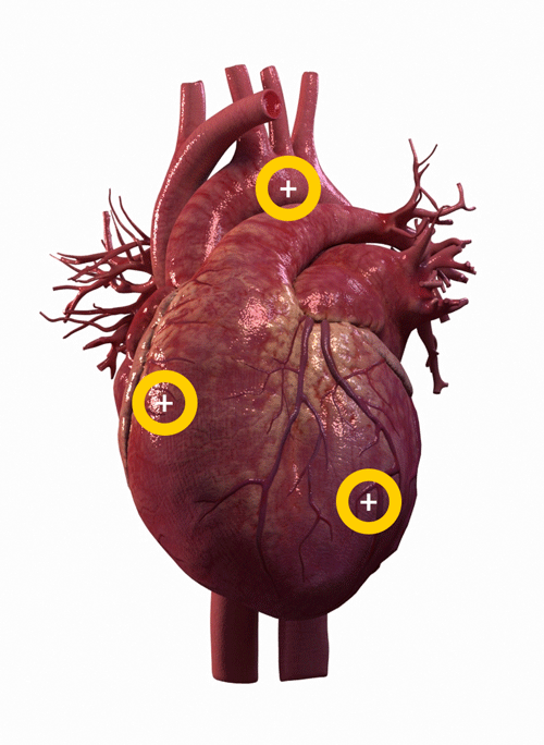 heart-21